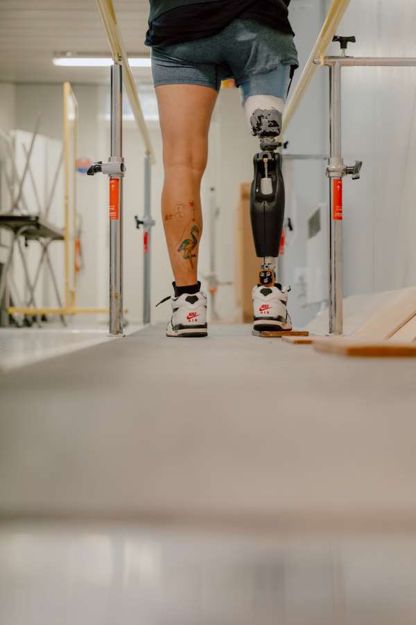 Patient appareillé d'une prothèse de jambe lors d'un exercice de marche entre les barres parallèles